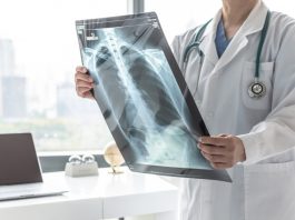 Examen radiologic: ce este, tipuri și la ce ajută Examen radiologic: ce este, tipuri și la ce ajută