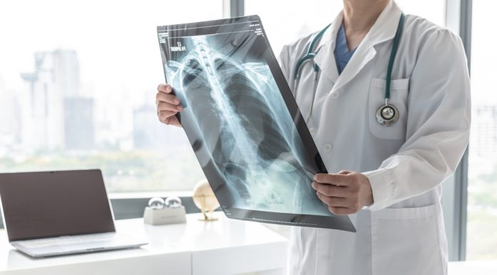 Examen radiologic: ce este, tipuri și la ce ajută Examen radiologic: ce este, tipuri și la ce ajută