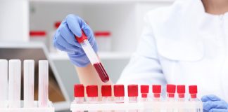 5 analize recomandate pentru identificarea nivelului de vitamine din organism 5 analize recomandate pentru identificarea nivelului de vitamine din organism