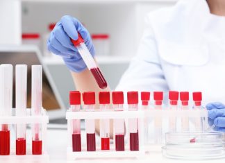 5 analize recomandate pentru identificarea nivelului de vitamine din organism 5 analize recomandate pentru identificarea nivelului de vitamine din organism