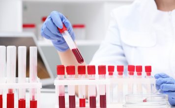 5 analize recomandate pentru identificarea nivelului de vitamine din organism 5 analize recomandate pentru identificarea nivelului de vitamine din organism
