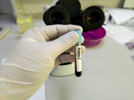 Cum funcționează proteina c reactivă în organismul uman Cum funcționează proteina c reactivă în organismul uman