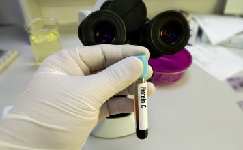 Cum funcționează proteina c reactivă în organismul uman Cum funcționează proteina c reactivă în organismul uman