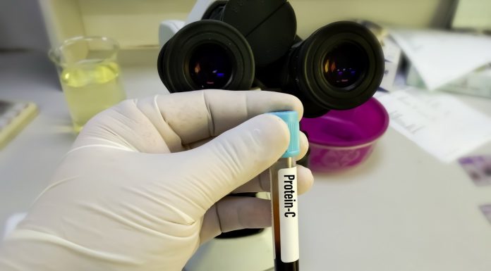 Cum funcționează proteina c reactivă în organismul uman Cum funcționează proteina c reactivă în organismul uman