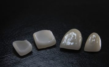 Este aceasta cea mai bună modalitate de a obține zâmbetul perfect? Este aceasta cea mai bună modalitate de a obține zâmbetul perfect