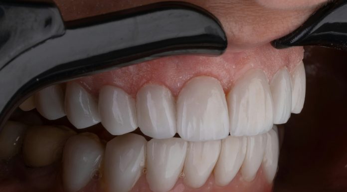 Tratamente moderne pentru reconstrucția dinților în București Tratamente moderne pentru reconstrucția dinților în București